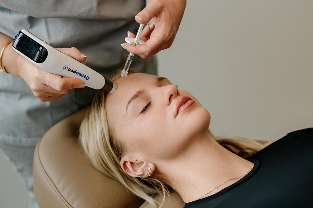 aesthetische-medizin-adliswil-zuerich- l-microneedling-v1